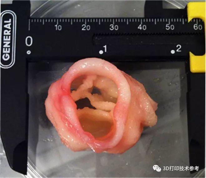 医疗奇迹：3D打印如何改善我们的生活