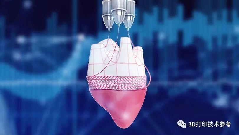 医学3D打印的主要类别及其改变该行业的方式