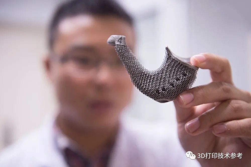 华西医院5年完成200多例3D打印植入手术，揭示行业发展痛点