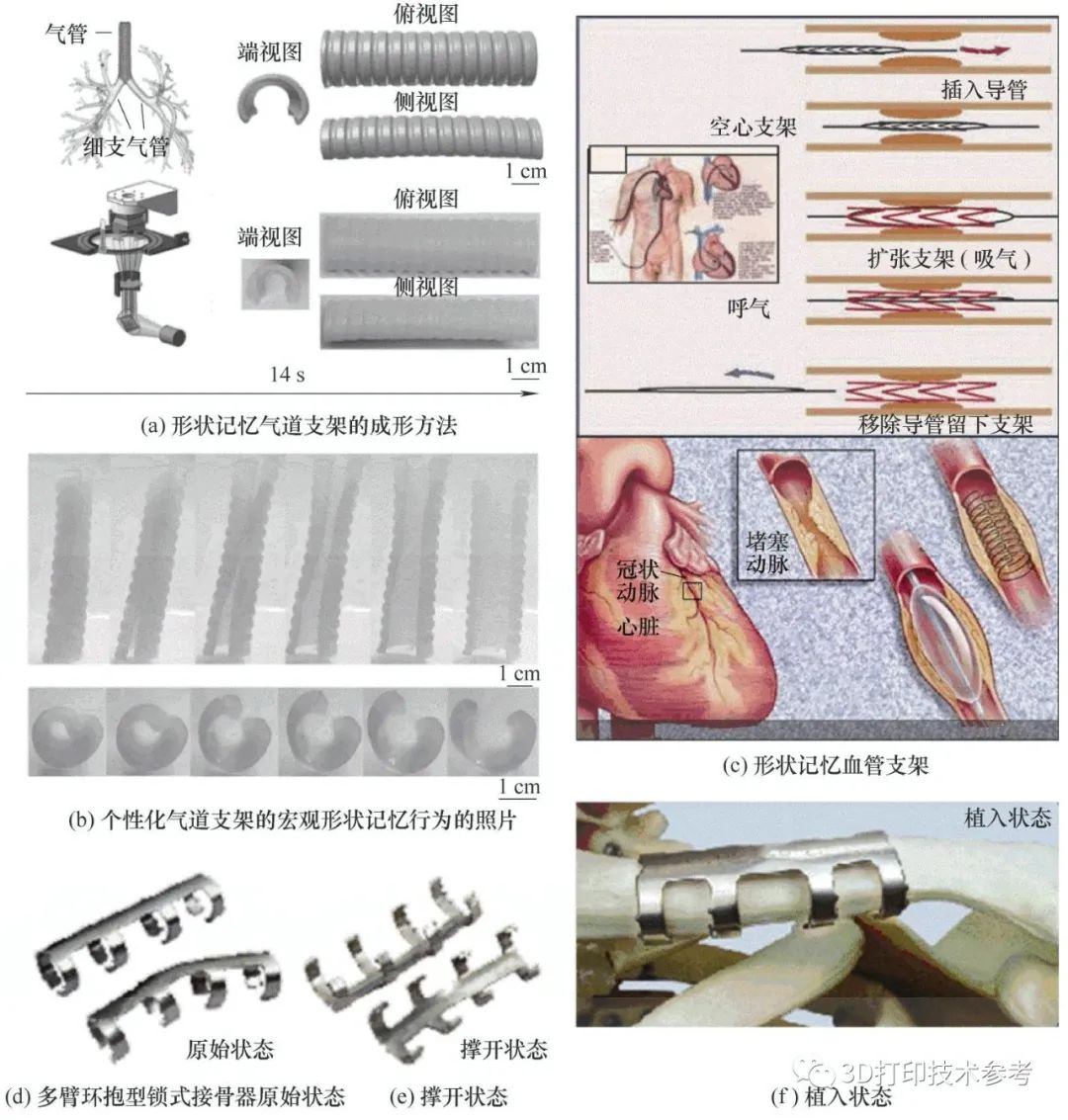 史玉升教授：4D打印智能构件的增材制造技术及应用领域