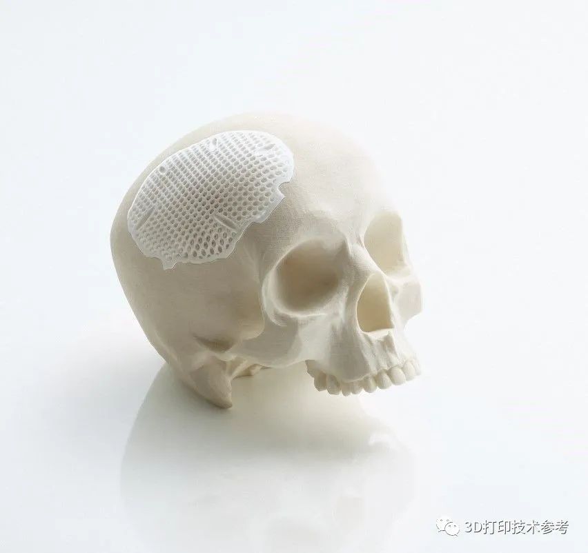 生物医疗领域使用陶瓷3D打印面临的挑战